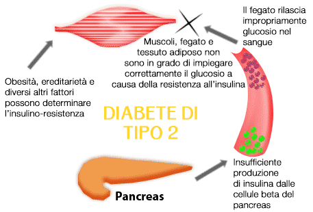 Diabete di tipo 2